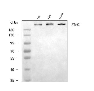 Anti-DEP1/PTPRJ Antibody Picoband® Boster Bio