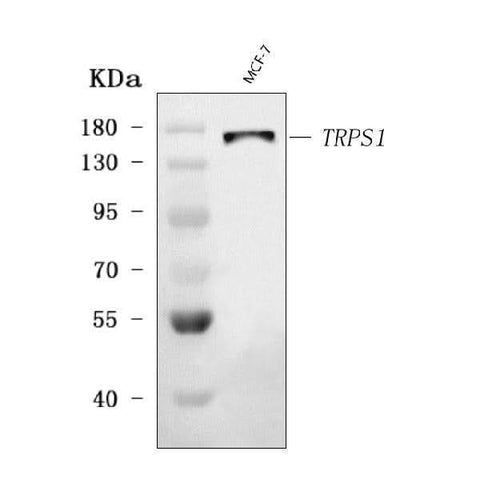 Anti-TRPS1 Antibody Picoband® Boster Bio