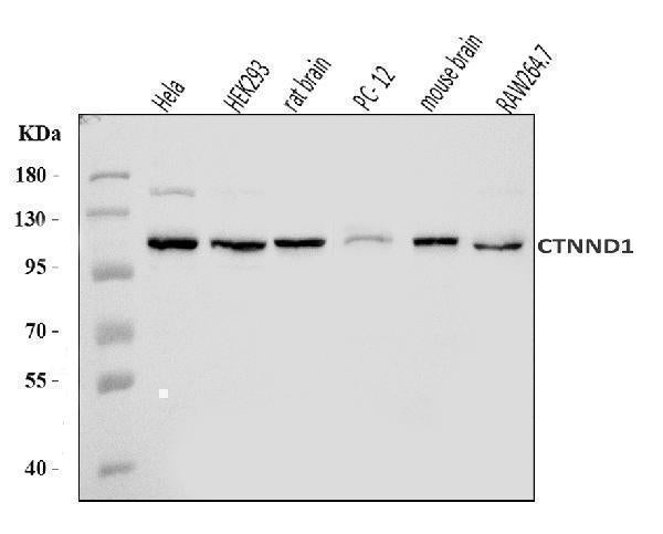 Anti-delta 1 Catenin/CAS/CTNND1 Antibody Picoband® Boster Bio