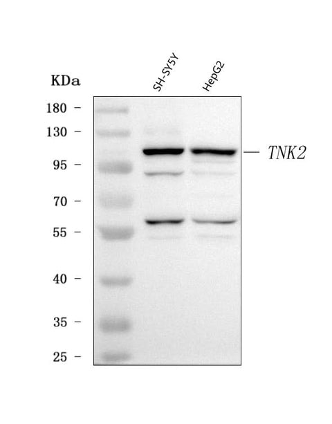 Anti-ACK1/TNK2 Antibody Picoband® Boster Bio