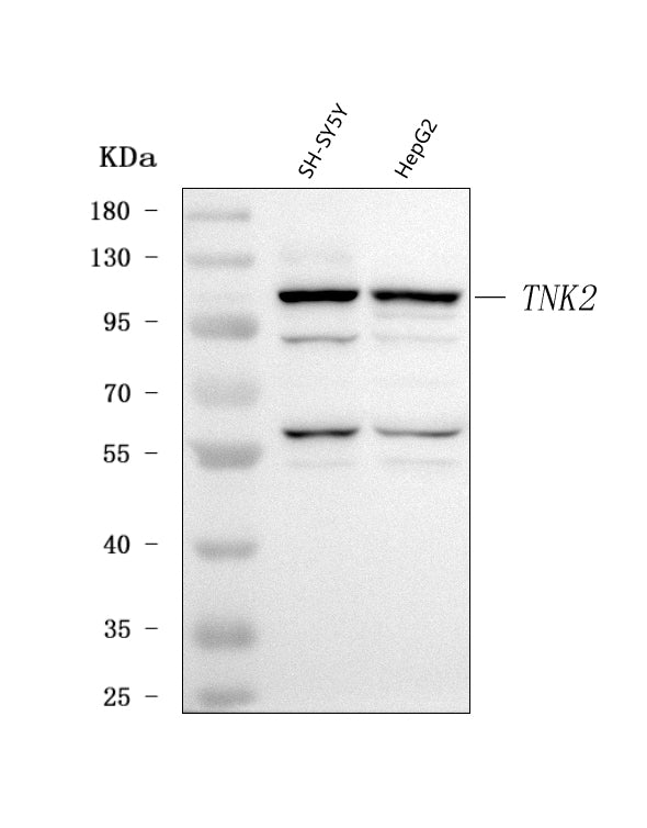 Anti-ACK1/TNK2 Antibody Picoband® Boster Bio