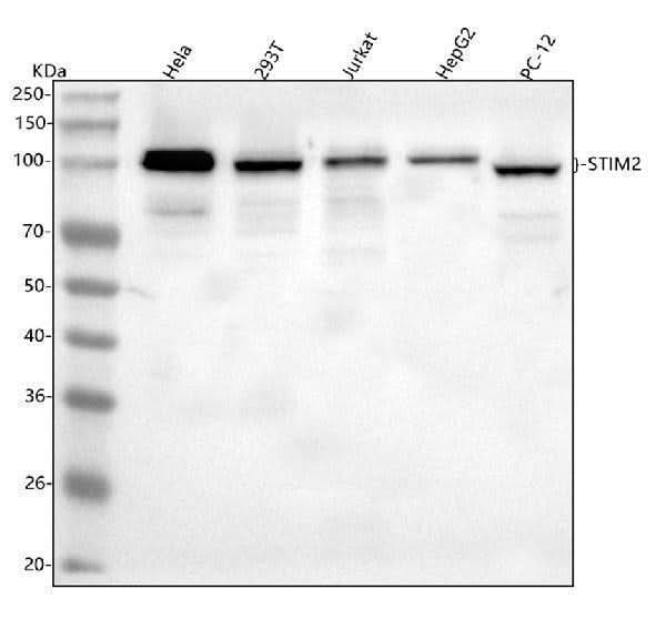 Anti-STIM2 Antibody Picoband® Boster Bio