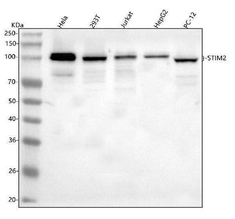 Anti-STIM2 Antibody Picoband® Boster Bio