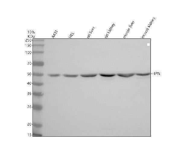 Anti-Hepsin/HPN Antibody Picoband® Boster Bio