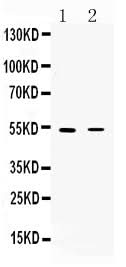 Anti-Nicotinic Acetylcholine Receptor alpha 5/CHRNA5 Antibody Picoband® Boster Bio