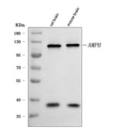Anti-Amphiphysin/AMPH Antibody Picoband® Boster Bio