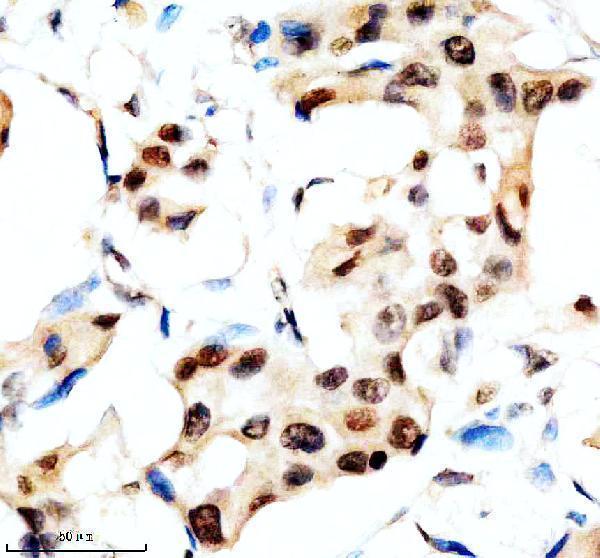 Anti-SLX4 Antibody Boster Bio