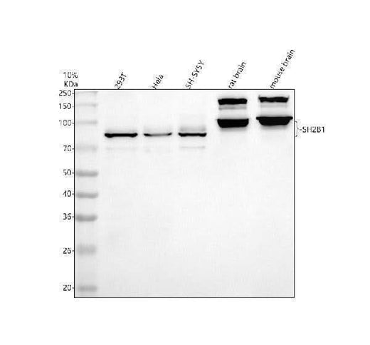 Anti-SH2B1 Antibody Picoband® Boster Bio