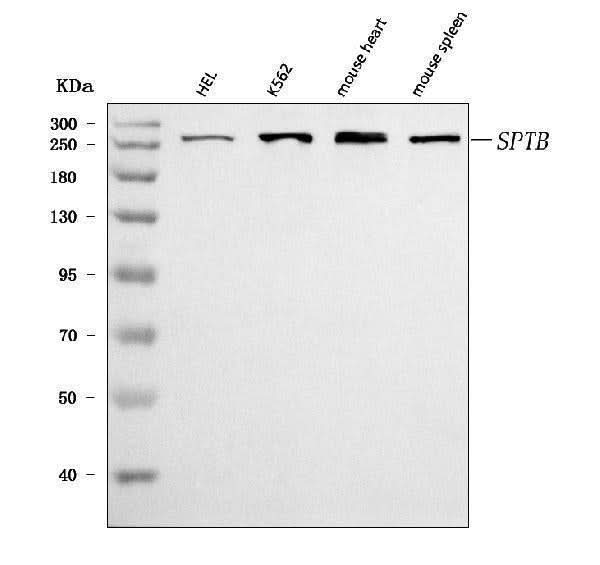 Anti-beta 1 Spectrin/SPTB Antibody Picoband® Boster Bio
