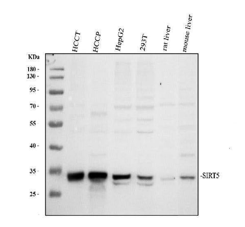 Anti-SIRT5 Antibody Picoband® Boster Bio