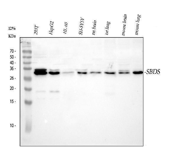 Anti-SBDS Antibody Picoband® Boster Bio