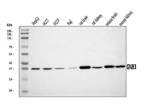 Anti-GNB3 Antibody Picoband® Boster Bio