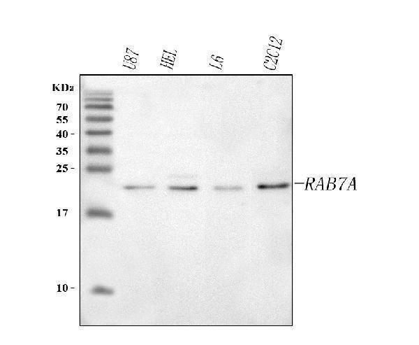 Anti-RAB7A Antibody Picoband® Boster Bio