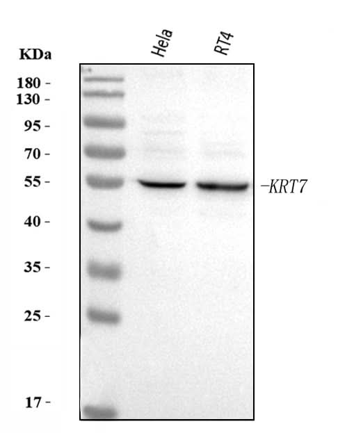 Anti-KRT7 Antibody Picoband® Boster Bio