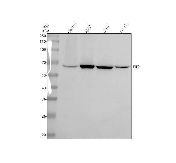 Anti-EIF2A Antibody Picoband® Boster Bio