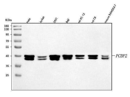 Anti-hnRNP E2/PCBP2 Antibody Picoband® Boster Bio