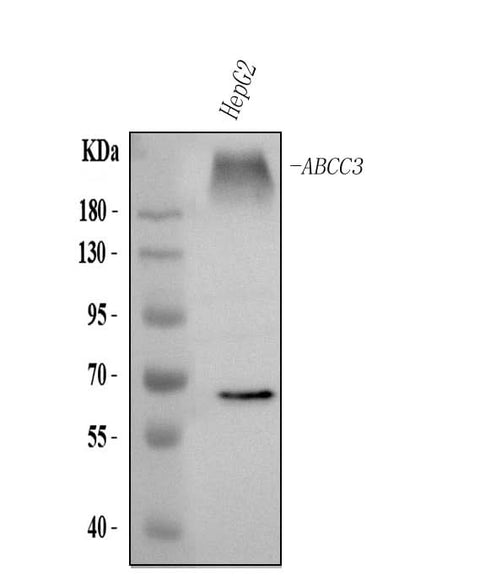 Anti-ABCC3 Antibody Picoband® Boster Bio