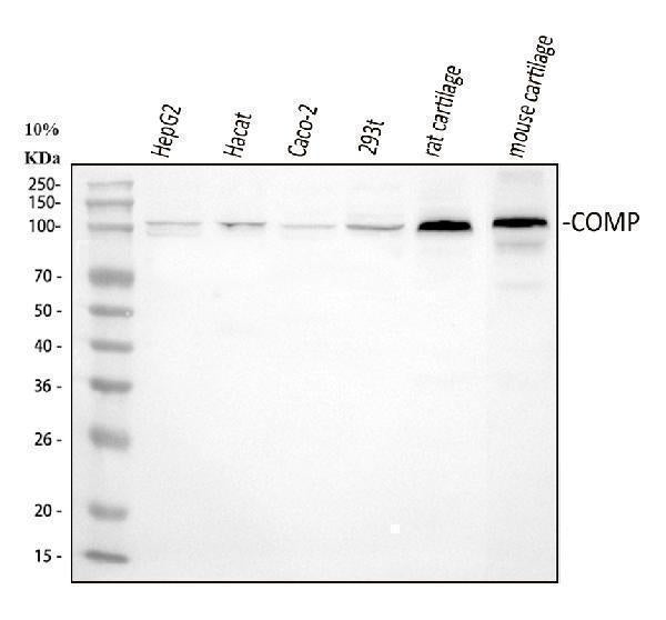Anti-COMP Antibody Picoband® Boster Bio