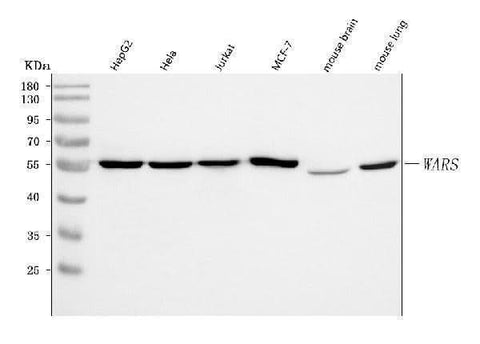 Anti-WRS/WARS1 Antibody Picoband® Boster Bio