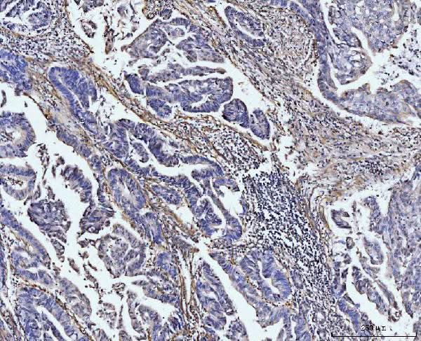 Anti-COL4A2 Antibody Boster Bio