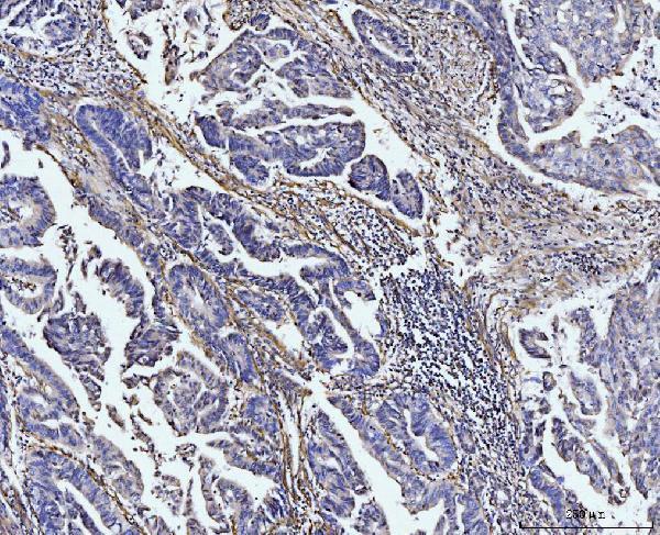 Anti-COL4A2 Antibody Boster Bio