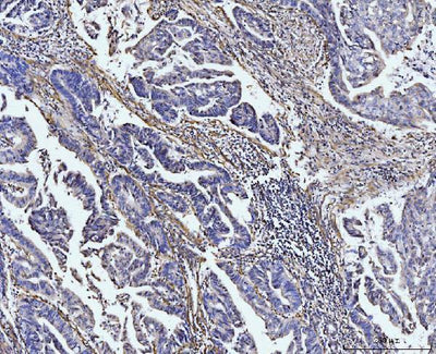 Anti-COL4A2 Antibody Boster Bio