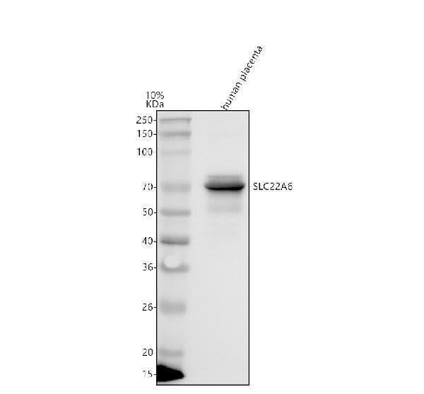 Anti-OAT1/SLC22A6 Antibody Picoband® Boster Bio