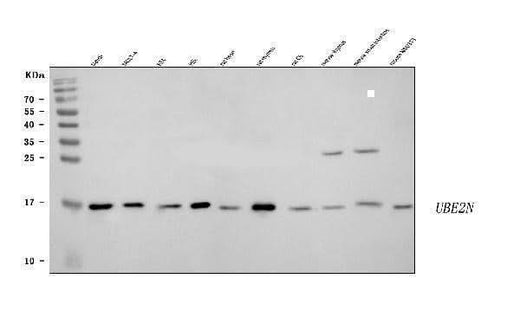 Anti-Ubc13/UBE2N Antibody Picoband® Boster Bio