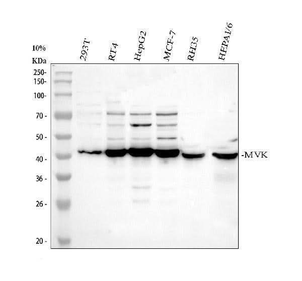 Anti-MVK Antibody Picoband® Boster Bio