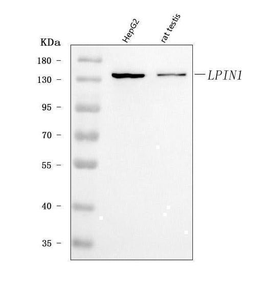 Anti-Lipin 1/LPIN1 Antibody Picoband® Boster Bio