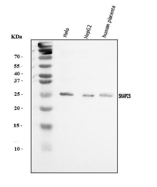 Anti-SNAP23 Antibody Picoband® Boster Bio