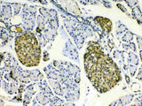 Anti-HSPB8/Hsp22 Antibody Picoband® Boster Bio