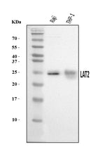 Anti-NTAL/LAT2 Antibody Picoband® Boster Bio