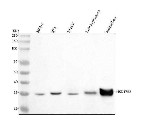Anti-HSD17B2 Antibody Picoband® Boster Bio