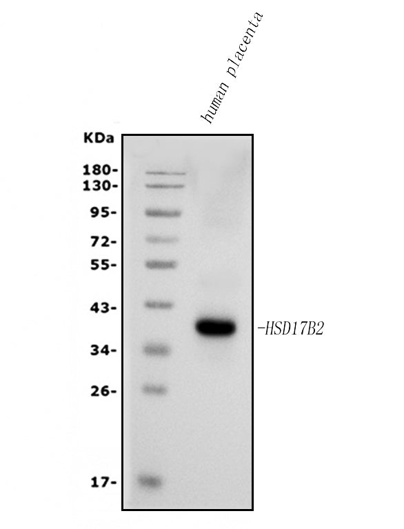 Anti-HSD17B2 Antibody Picoband® Boster Bio