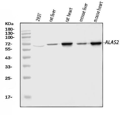 Anti-ALAS2/ASB Antibody Picoband® Boster Bio