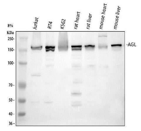 Anti-AGL Antibody Picoband® Boster Bio