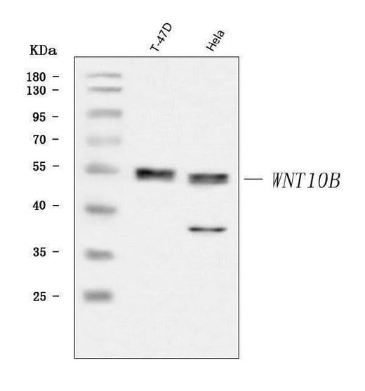 Anti-WNT10B Antibody Picoband® Boster Bio