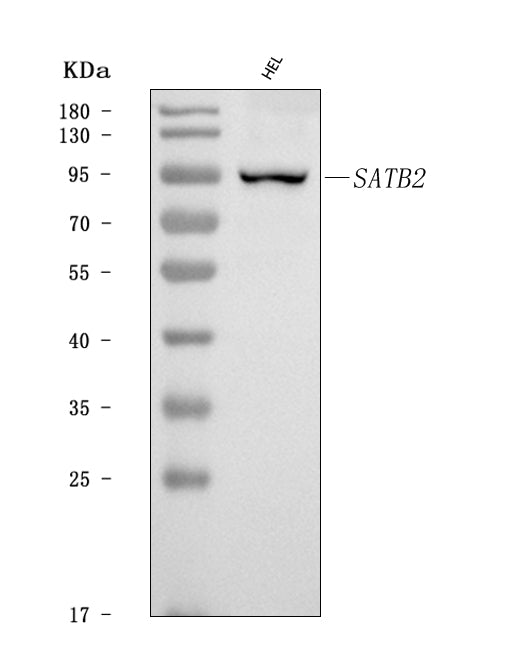 Anti-SATB2 Antibody Picoband® Boster Bio