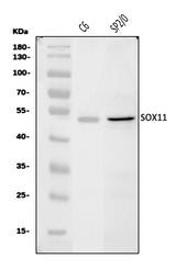 Anti-Sox11 Antibody Picoband® Boster Bio