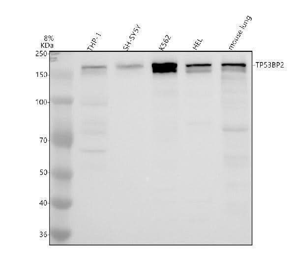 Anti-53BP2/TP53BP2 Antibody Picoband® Boster Bio