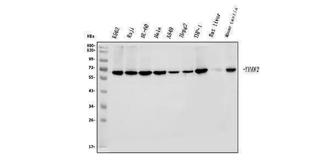 Anti-YTHDF2 Antibody Picoband® Boster Bio