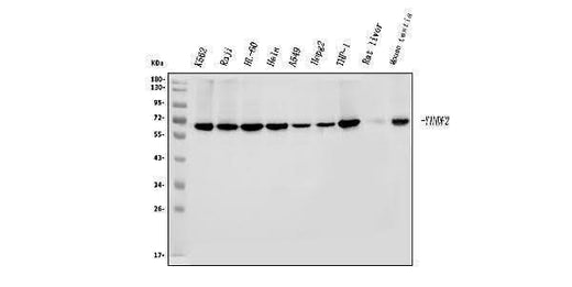 Anti-YTHDF2 Antibody Picoband® Boster Bio