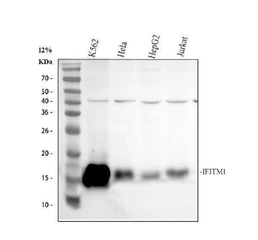 Anti-IFITM1 Antibody Picoband® Boster Bio