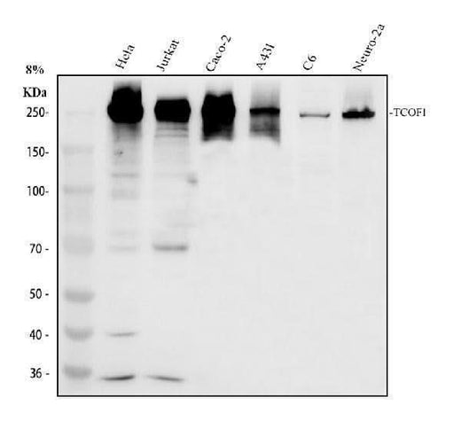 Anti-TCOF1 Antibody Picoband® Boster Bio