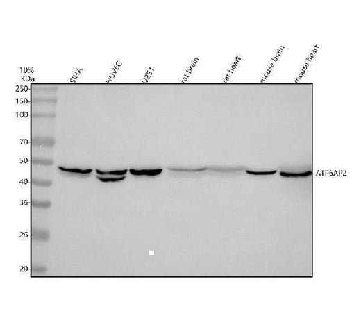 Anti-Renin receptor/ATP6AP2 Antibody Picoband® Boster Bio