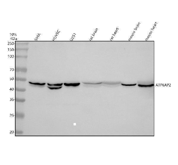 Anti-Renin receptor/ATP6AP2 Antibody Picoband® Boster Bio