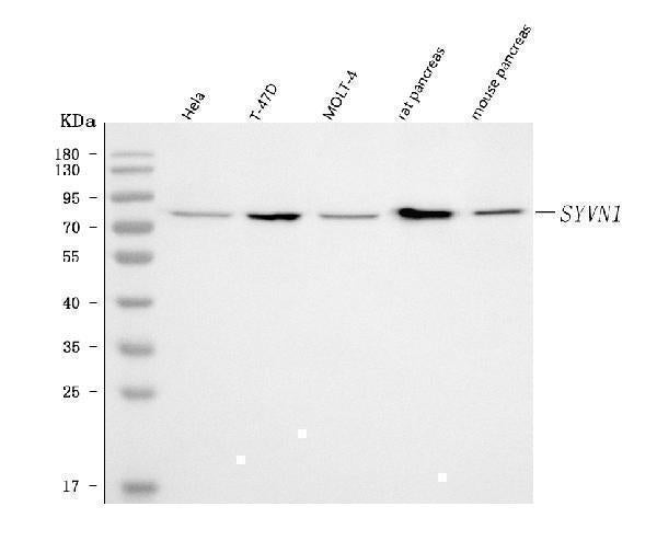 Anti-HRD1/SYVN1 Antibody Picoband® Boster Bio