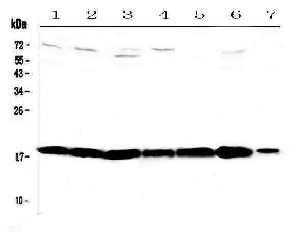 Anti-HE4/Wfdc2 Antibody Picoband® Boster Bio