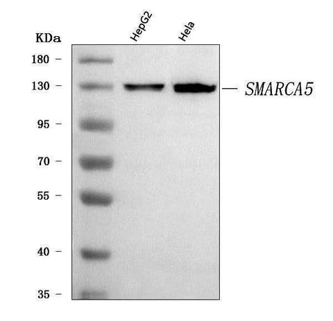 Anti-SNF2H/SMARCA5 Antibody Picoband® Boster Bio
